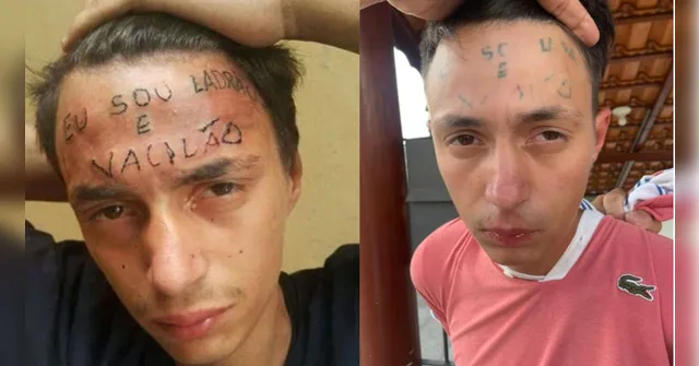 Imagem ilustrativa da notícia Homem que foi tatuado na testa à força volta a assaltar