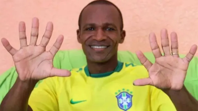 Imagem ilustrativa da notícia Brasileiro com seis dedos na mão já se considera hexa
