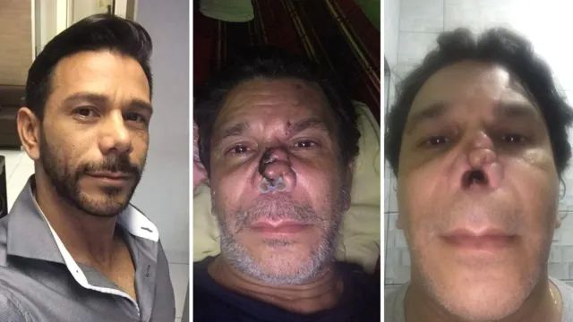 Imagem ilustrativa da notícia Família pede ajuda para cirurgias de paraense no nariz