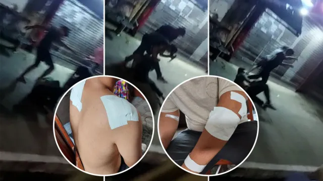 Imagem ilustrativa da notícia Vídeo: jovem é esfaqueado 8 vezes durante assalto em Belém