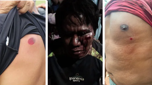 Imagem ilustrativa da notícia Vídeo: indígenas Tembé denunciam extermínio no PA