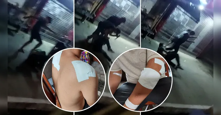 Imagem ilustrativa da notícia Vídeo: jovem é esfaqueado 8 vezes durante assalto em Belém