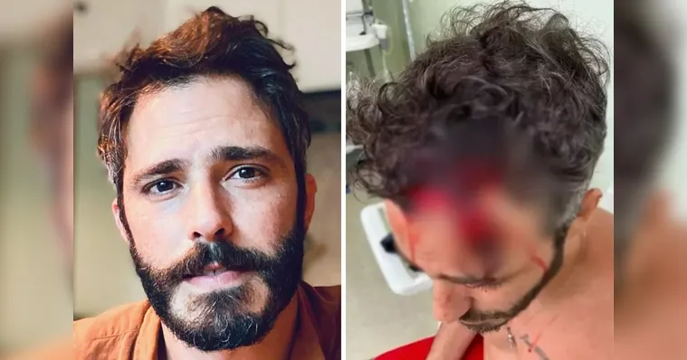 Imagem ilustrativa da notícia Polícia investiga se Thiago Rodrigues mentiu sobre agressão 