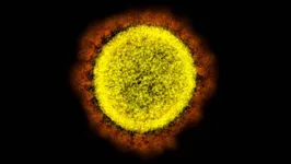 Vírus Sars-CoV-2 registrado por microscópio em laboratório do US National Institute of Allergy and Infectious Diseases (NIAIDI).