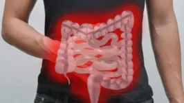 Imagem ilustrativa da notícia Alerta: confira sinais do câncer de intestino
