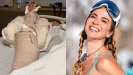 Luciana Gimenez sofreu um acidente enquanto esquiava com os filhos, em Aspen, nos Estados Unidos.