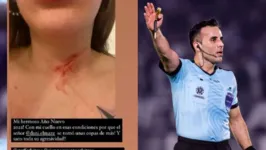 Pollett López usou os Stories do Instagram para denunciar agressão que teria sofrido do ex-marido, o árbitro chileno Piero Maza.