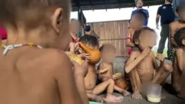 Crianças Yanomami desnutridas