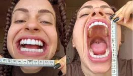 Rochelle Garett quer entrar para o Livro Guinness dos Recordes com a maior boca do mundo