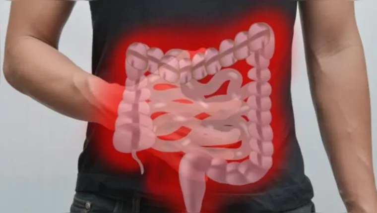 Imagem ilustrativa da notícia Alerta: confira sinais do câncer de intestino