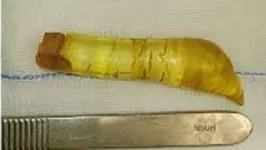 Massa de silicone que se formou media 12 cm