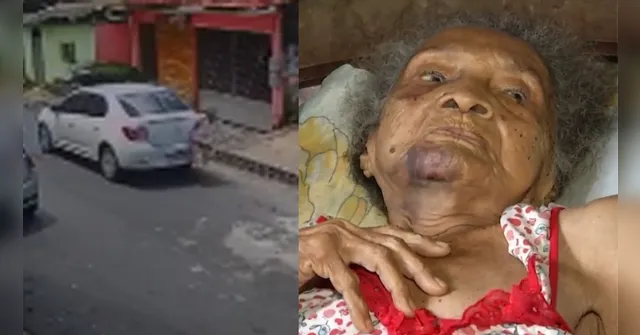 Imagem ilustrativa da notícia Idosa de 102 anos atropelada em Belém não resiste e morre