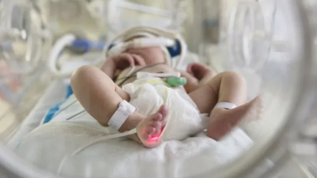 Imagem ilustrativa da notícia Covid-19 em grávidas afeta cérebro de bebês, diz estudo