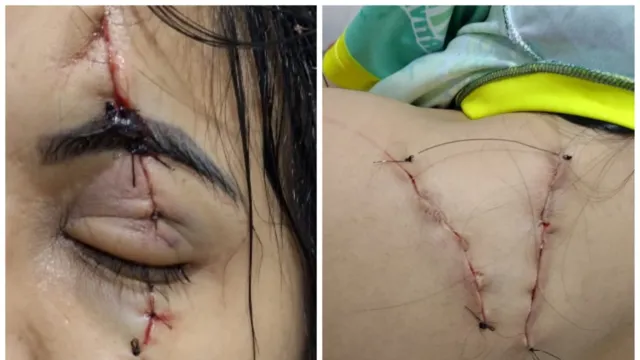 Imagem ilustrativa da notícia Vídeo: Mulher é atacada com golpes de bisturi no rosto no PA