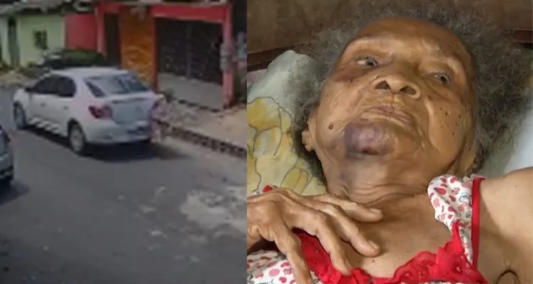 Imagem ilustrativa da notícia Idosa de 102 anos atropelada em Belém não resiste e morre