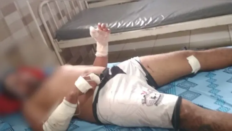 Imagem ilustrativa da notícia Pará: homem atacado por Pitbull mata animal ao se defender