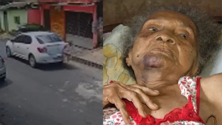 Imagem ilustrativa da notícia Idosa de 102 anos atropelada em Belém não resiste e morre