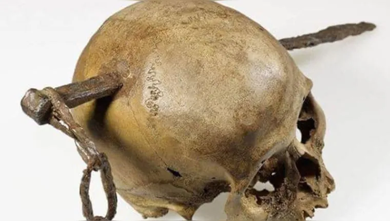 Imagem ilustrativa da notícia Crânio com estaca de ferro cravado é achado no Reino Unido