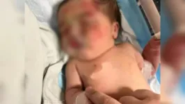 Alguns portais locais apontam que ela tinha horas de vida