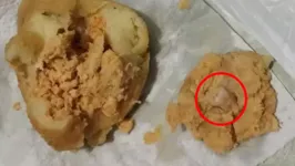 Mulher encontrou dente humano após morder coxinha