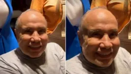 A assessora pessoal dele resolveu publicar um vídeo para mostrar que fora da televisão e dos holofotes, o rosto dele está "normal".