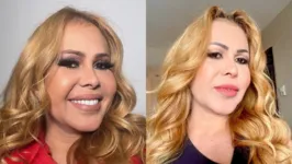 Desde que foi diagnosticada pela última vez em novembro do ano passado, Joelma tem enfrentado as sequelas da Covid-19