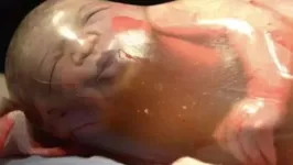 É muito raro quando um bebê nasce envolto pelo saco amniótico