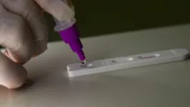 Laboratórios aplicavam teste-rápido como se fosse RT-PCR, mais caro