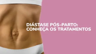 Imagem ilustrativa do vídeo: Diástase pós-parto: Conheça tratamentos para reverter