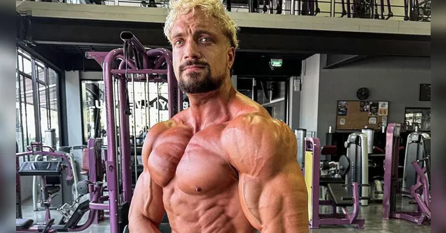Imagem ilustrativa da notícia Fisiculturista morre aos 30 anos vítima de aneurisma