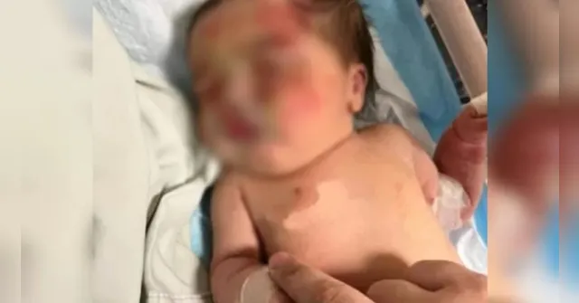 Imagem ilustrativa da notícia Bebê abandonada é encontrada em sacola carregada por cão