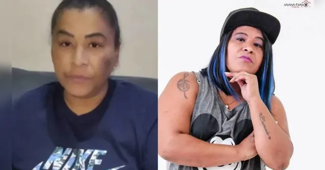 Imagem ilustrativa da notícia MC lamenta mioma e cigarro após ter parte do pé amputado