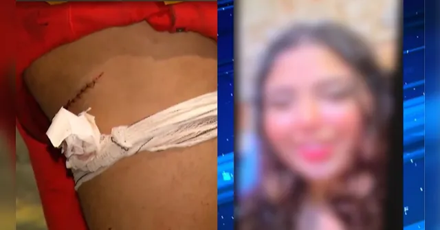 Imagem ilustrativa da notícia Ex-namorada ataca jovem de 19 anos com estilete em Belém