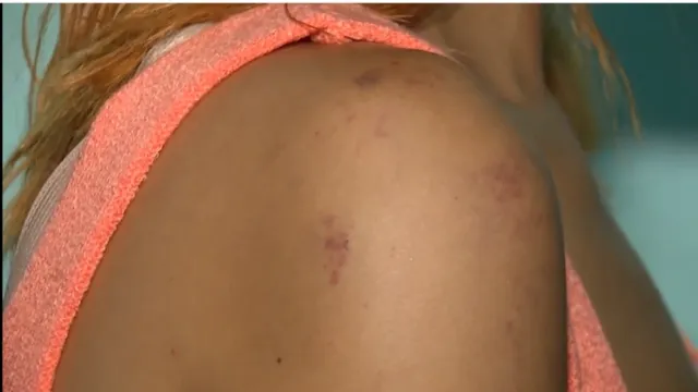 Imagem ilustrativa da notícia Vídeo: vítima que foi agredida com capacete conta detalhes