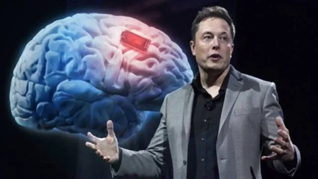 Imagem ilustrativa da notícia Elon Musk é autorizado a testar chip cerebral em humanos