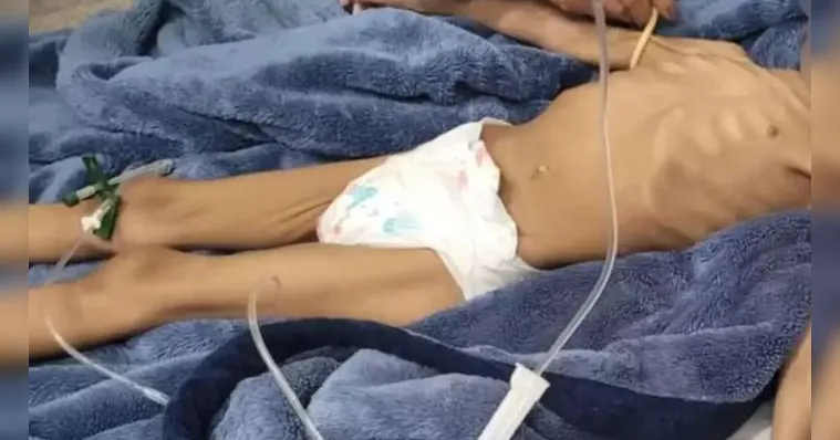 Imagem ilustrativa da notícia Pai preso após deixar filha de 3 anos sem comer por 40 dias