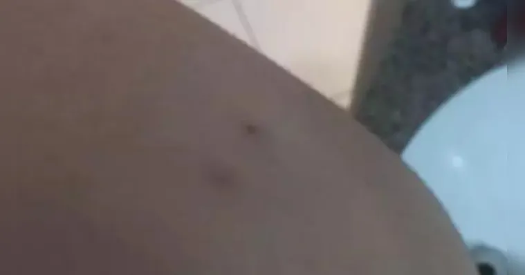 Imagem ilustrativa da notícia Mãe narra "saga" após filho ser mordido por morcego em Belém