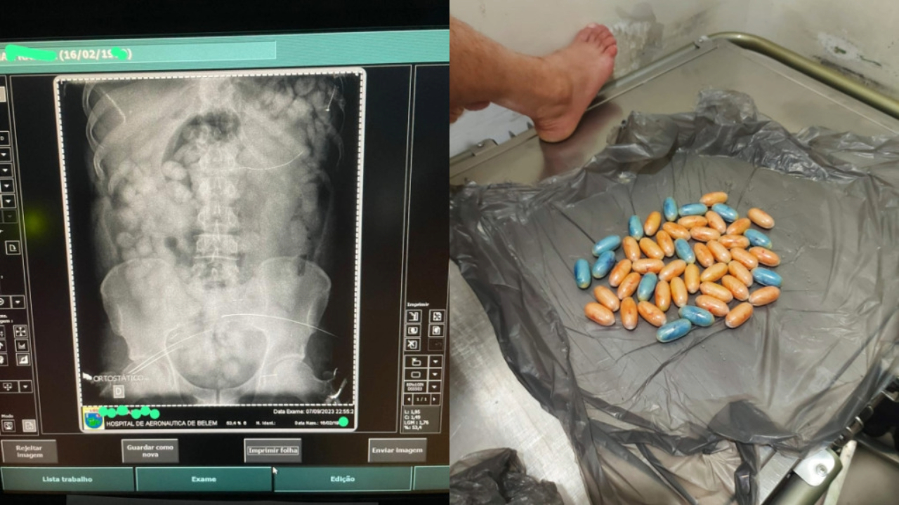 Un homme arrêté avec 80 capsules de drogue dans le ventre à Belém • DOL