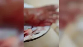 O menino foi socorrido e levado para o Pronto Socorro Municipal