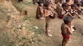 Crianças yanomami com desnutrição na região de Surucucu, na Terra Yanomami