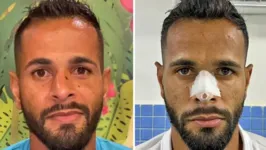 Zagueiro Naylhor teve o nariz fraturado após soco desferido pelo presidente do Amazonas