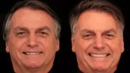 O dentista de Bolsonaro mostrou o resultado do procedimento.