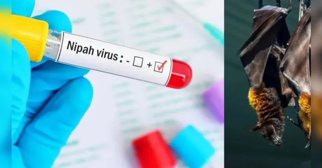 Imagem ilustrativa da notícia Vírus Nipah pode chegar ao Brasil e causar pandemia? Veja!
