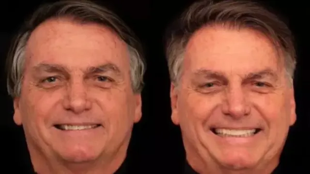 Imagem ilustrativa da notícia Bolsonaro faz harmonização de rosto e dentes por R$ 84 mil