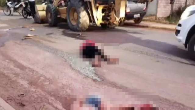 Imagem ilustrativa da notícia Casal em moto colide com trator em Mojuí dos Campos, no Pará