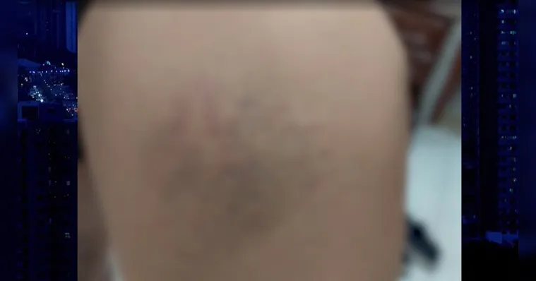 Imagem ilustrativa da notícia Vídeo: Criança autista é agredida em escola de Belém