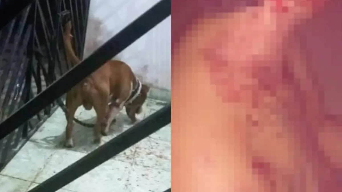 Imagem ilustrativa da notícia Pitbull ataca mãe e filho dentro de casa na Grande Belém