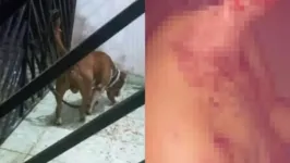 Cachorro pitbull teria deixado criança bastante ferida após ataque em casa no município de Castanhal