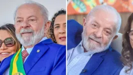 Antes e depois de Lula após cirurgia plástica