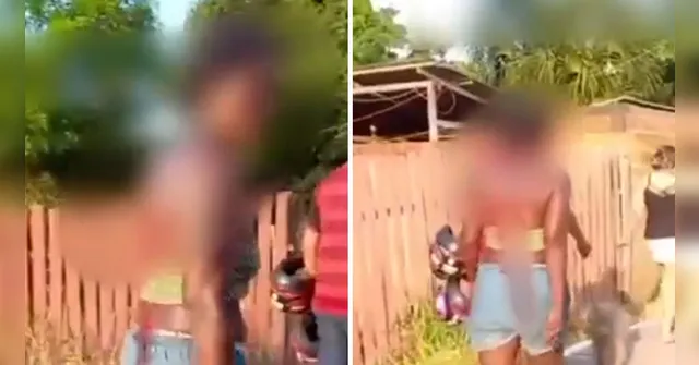 Imagem ilustrativa da notícia Vídeo: mulher fica com faca nas costas após briga de família